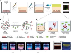 At-Home Testing for Early Detection of Bladder Cancer: A Breakthrough