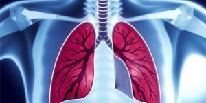 Enhanced Survival Rates Observed with Anatomic Lung Resection in