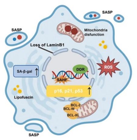 Exploring the Dual Role of Senescence in Liver Disease: Insights and