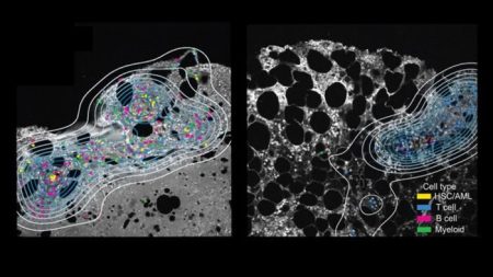 Rewrite Study unveils key immune cells found to boost cancer treatment