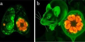 Single Dose Drug Candidate Successfully Eradicates Breast Cancer Tumors in