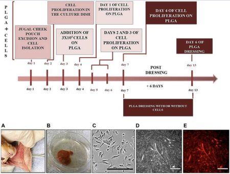 Groundbreaking Biomaterial Enhances Recovery from Chemotherapy-Related Oral