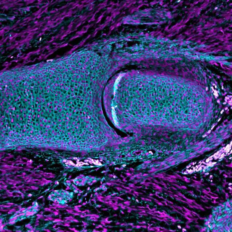 Humans have the earliest jawed fish to thank for their flexible joints, study suggests