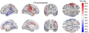 Revolutionary AI Model Reveals Insights into the Rate of Brain Aging