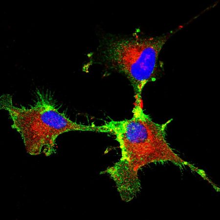 Breakthrough Research Pinpoints Crucial Protein Driving Glioblastoma