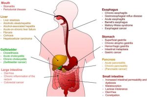 Impact of Ethanol Consumption on Digestive Health: A Scientific Overview