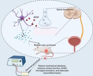 Innovative Treatment Approaches Emerging for Neglected Bladder Disorder